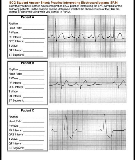 Ecg Student Answer Sheet Practice Interpreting Chegg