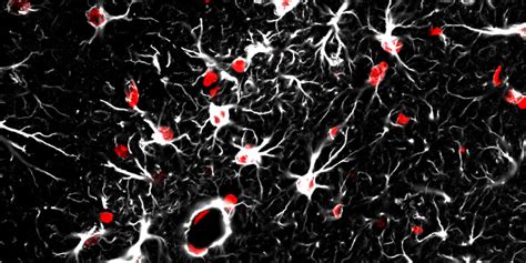 Star Shaped Brain Cells Called Astrocytes Implicated In Brain S Aging