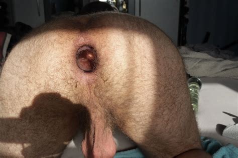 Plug De Vidro Anal Pics XHamster