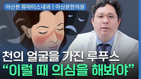 류마티스내과루푸스 피부 관절 장기에 문제를 일으키는 무서운 자가면역질환 L 강동구류마티스내과 Youtube