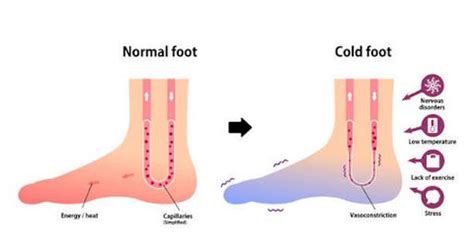 Cold feet symptoms and it's causes – HappyWalk - Orthopedic & Diabetic ...