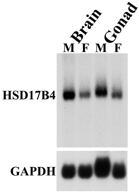 Northern Blot Hybridization Shows Sex Difference In Hsd17b4 Mrna