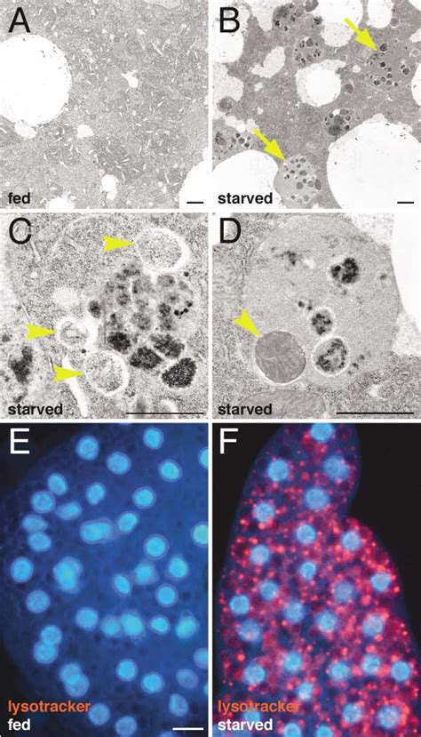 Figure From Role And Regulation Of Starvation Induced Autophagy In