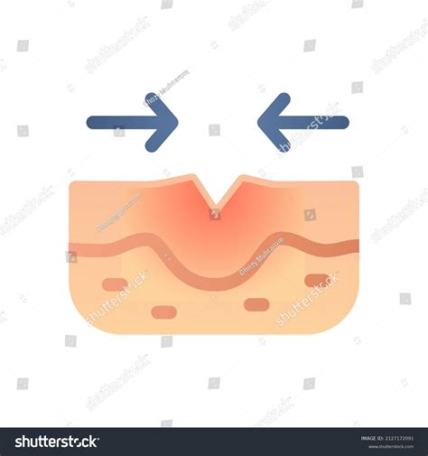 10433 Wound Healing Vector Images Stock Photos And Vectors Shutterstock