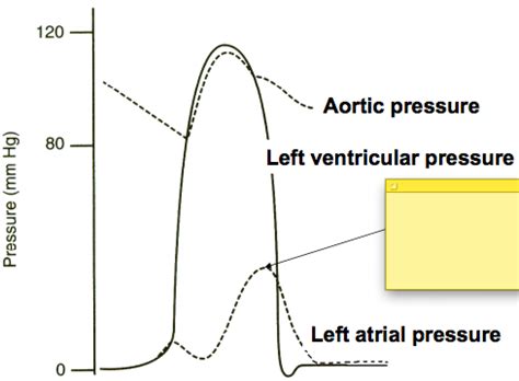 Physio Exam Flashcards Quizlet