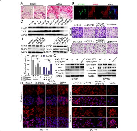 Cxcl5 Localization In Crc Tissues The Expression Of Cxcl5 In Crc Cell