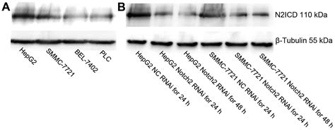 Notch2 is a crucial regulator of self-renewal and tumorigenicity in ...