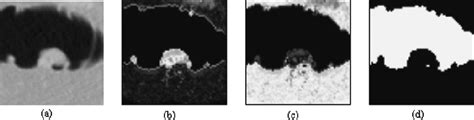 Figure 1 From Colonic Polyp Segmentation In Ct Colonography Based On