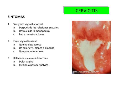 Ppt Entrenamiento Resumen Y Actualización Javier Sarmiento G Md