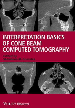 Interpretation Basics Of Cone Beam Computed Tomography Wiley