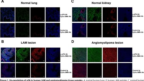 Figure From Urokinase Type Plasminogen Activator Upa Is Critical