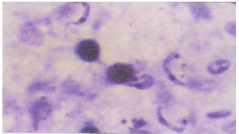 Microbiologia Y Parasitologia 2e Unpa Trypanosoma Cruzy Inés Yanet Toledo López