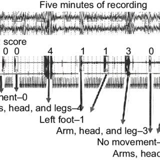 Pdf The Level Of Observed Physical Movement Accompanying Periodic