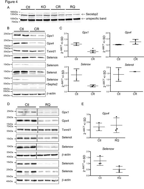 Selenoprotein Expression In Neuron Specific Secisbp Mutant Mice A