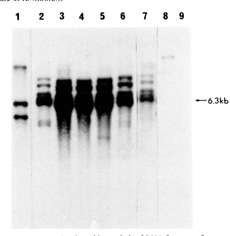 Figure 1 From A Gene Coding For The Uric Acid Xanthine Permease Of