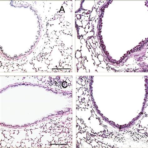 Development Of Goblet Cell Hyperplasia In Blt1 And Blt1 Mice