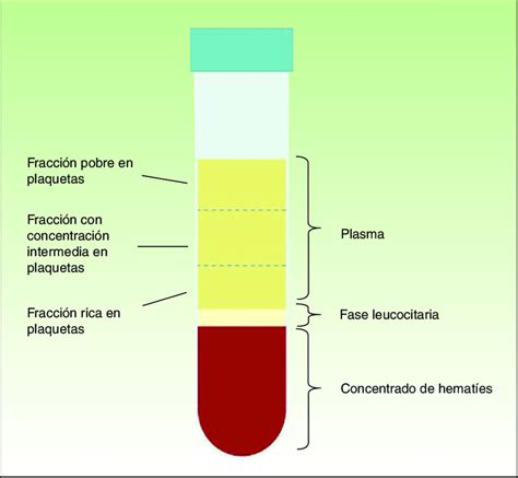 Sangre Metodo De Separacion Buick