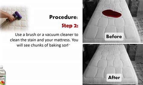 9 Stain-Saving Secrets To Get Blood Out Of Your Mattress