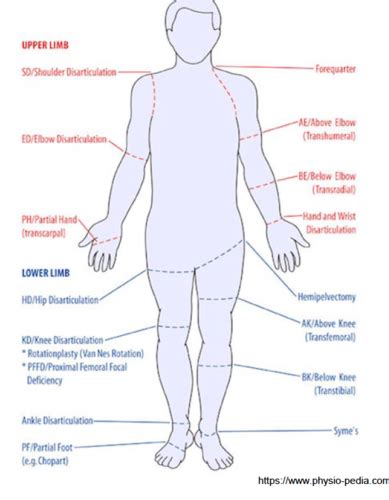 PHTH 564 - Lecture #7 + #8: Limb Loss Rehab - (Introduction to Lower ...