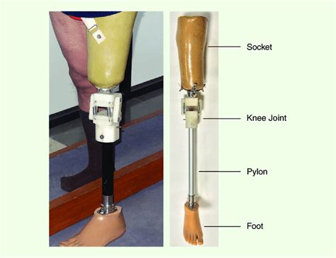 Parts Of A Prosthetic Leg