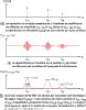 Tomographie Par Coh Rence Optique Oct Technologie Et Applications