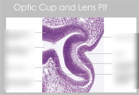 histo of optic cup and lens pit Diagram | Quizlet