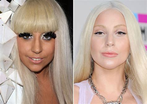 Lady Gaga Before And After Lady Gaga Plastic Surgery Celebrity