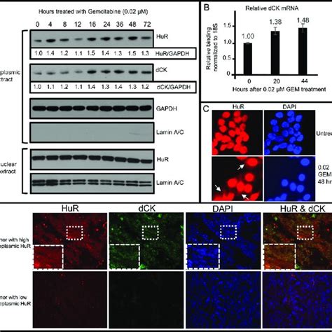 HuR Nuclear To Cytoplasmic Translocation Following Treatment Of OVCAR5