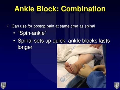 Lecture 4 And 5 Parekh Regional Anesthesia