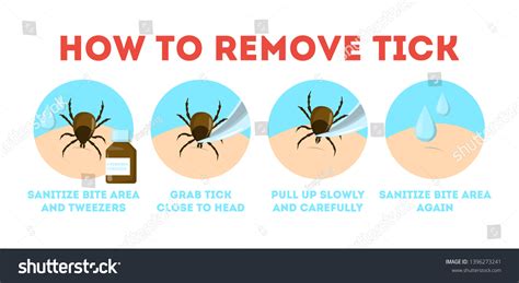 Tips Tick Safety Infographic How Remove เวกเตอร์สต็อก ปลอดค่า