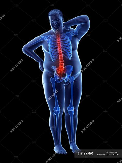 Obese male full length silhouette with back pain, digital illustration