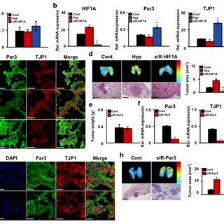 Effects of HIF 1α and Par3 on OSCC tumor metastasis in vivo HSC 2