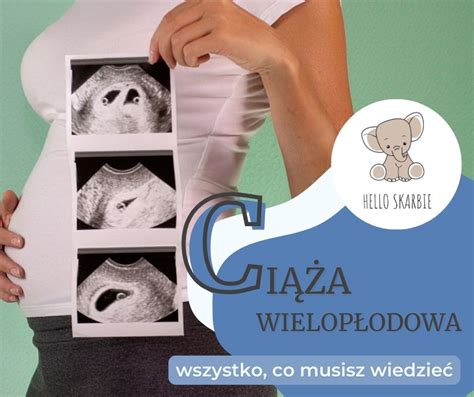 Ciąża wielopłodowa wszystko co musisz o niej wiedzieć