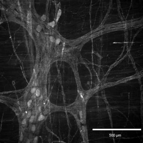 Immunohistochemistry Of Porcine Enteric Neurons