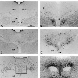 Alzheimer S Disease Ad Related Cytoskeletal Changes In The