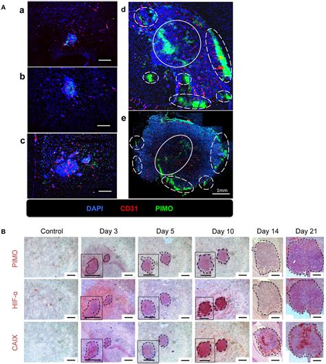 The Temporal And Spatial Pattern Of Tumor Hypoxia Associated Markers