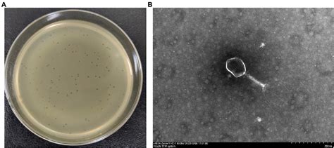 Frontiers Characterization Of A Lytic Escherichia Coli Phage Ce And