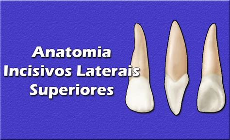 Aula De Anatomia Dental Incisivo Lateral Superior Dente E