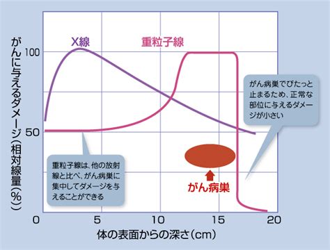 重粒子線治療とは 神奈川県立がんセンター 重粒子線治療施設【i Rock】