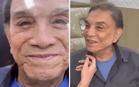 Aos 86 anos Dedé Santana também realizou harmonização facial e