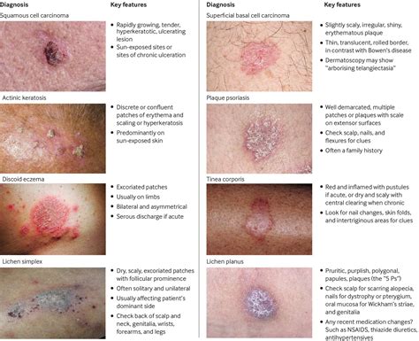 Bowens Disease The Bmj