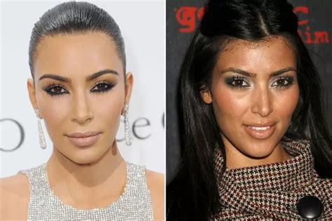 Kim Kardashian S Plastic Surgery Timeline In Full As Star Exposes Her