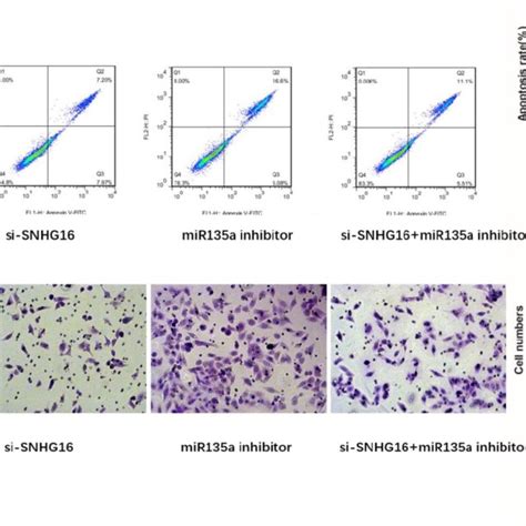 Effects Of Si SNHG16 And MiR135a Inhibitor On Cell Invasion And