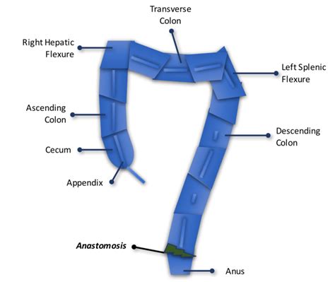 Low Anterior Resection Surgery — Love Your Buns