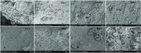Scanning electron microscope micrographs at (A) × 5000 and (B) × 10000 ... 