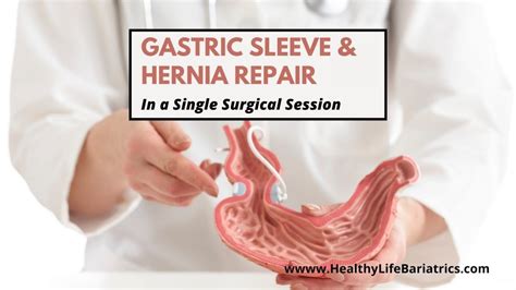 Hiatal Hernia Repair And Sleeve Gastrectomy In La Ca Hlb