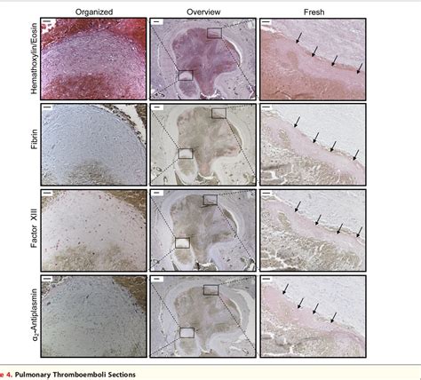 Figure From Molecular Mri Of Early Thrombus Formation Using A Bimodal