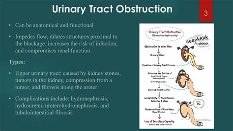 SOLUTION Alteration Of Renal And Urinary Tract Function Studypool