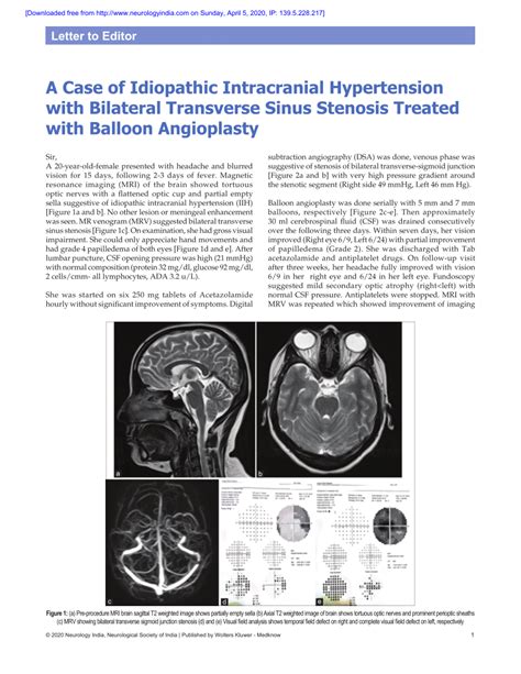 Pdf A Case Of Idiopathic Intracranial Hypertension With Bilateral