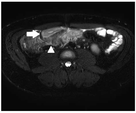 Diagnostics Free Full Text Replacing Endoscopy With Magnetic